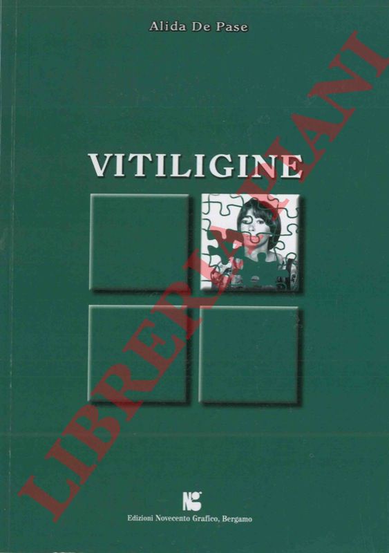 DE PASE Alida - - Vitiligine.