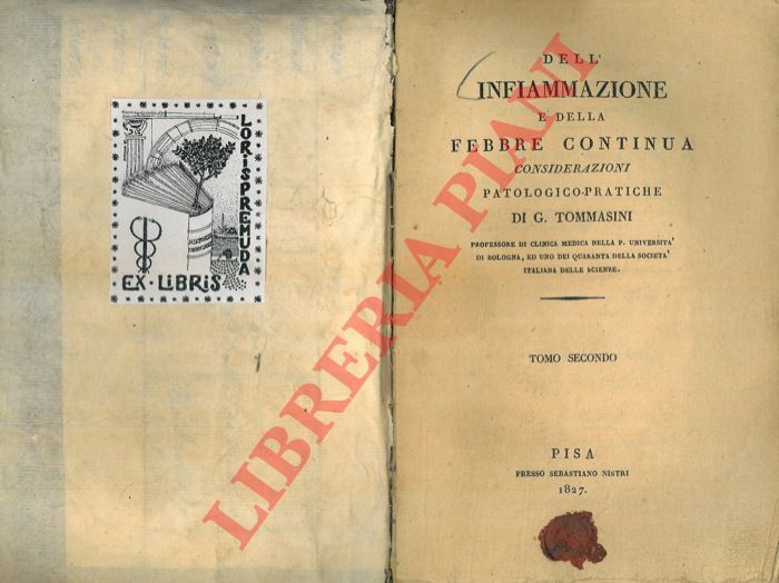 TOMMASINI G. - - Dell'infiammazione e della febbre continua. Considerazioni patologico-pratiche. Tomo secondo.