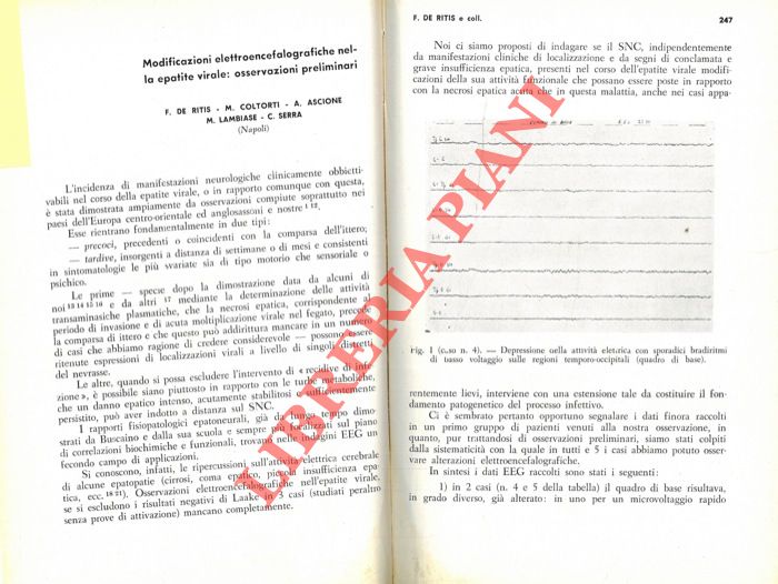 Modificazioni elettroencefalografiche nella epatite virale: osservazioni preliminari. - DE RITIS F. - COLTORTI M. - ASCIONE A. - LAMBIASE M. - SERRA C. -