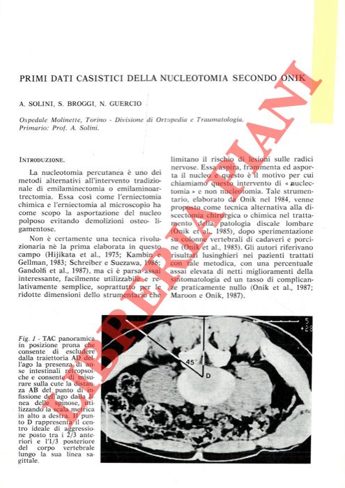 Primi dati casistici della nucleotomia secondo Onik. - SOLINI A. - BROGGI S. - GUERCIO N. -