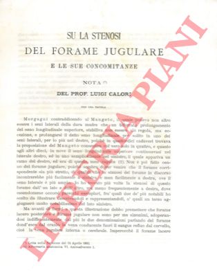 CALORI Luigi - - Su la stenosi del forame jugulare e le sue concomitanze. 