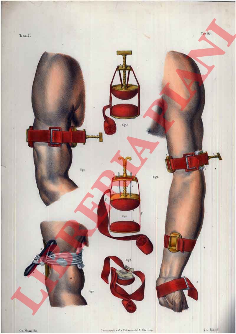 (Bourgery) - - Compressione delle arterie del membro toracico.