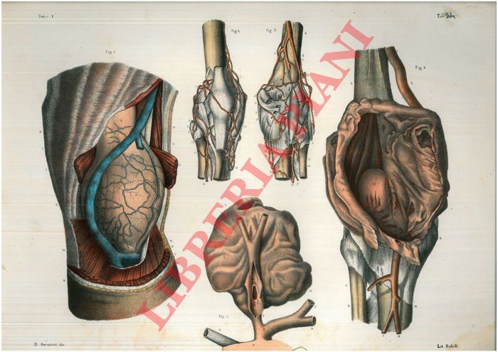 (Bourgery) - - Resultato dell'allacciatura dei tronchi arteriosi principali.