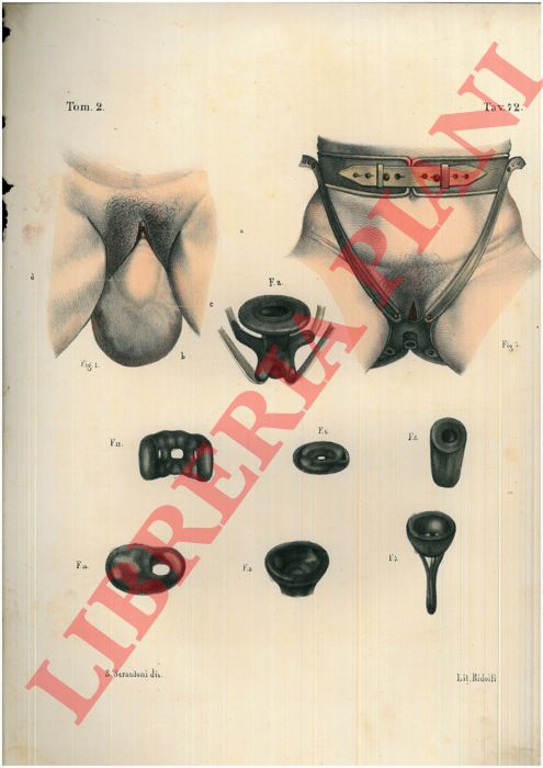 (Bourgery) - - Malattie dell'utero  (1).